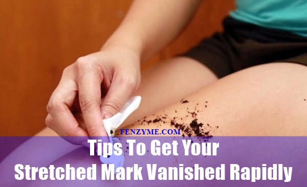 tips-to-get-your-stretched-mark-vanished-rapidly-16