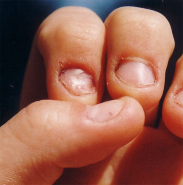 short nail shapes short nail shapes